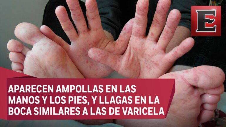 puntos rojos en la palma de la mano